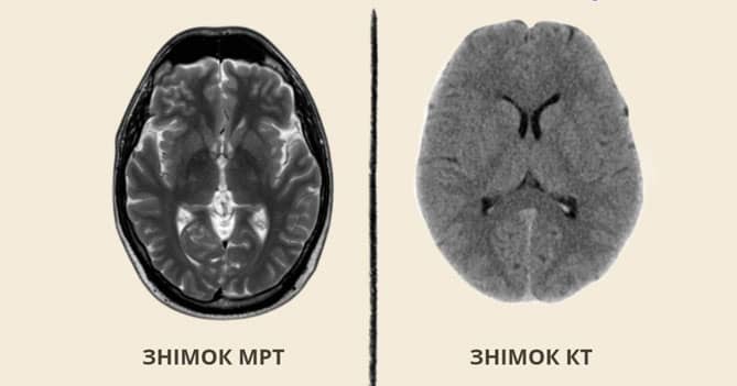 МРТ чи КТ: в чому різниця?