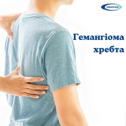Гемангіома хребта-що це?