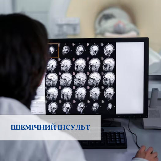 Ішемічний інсульт