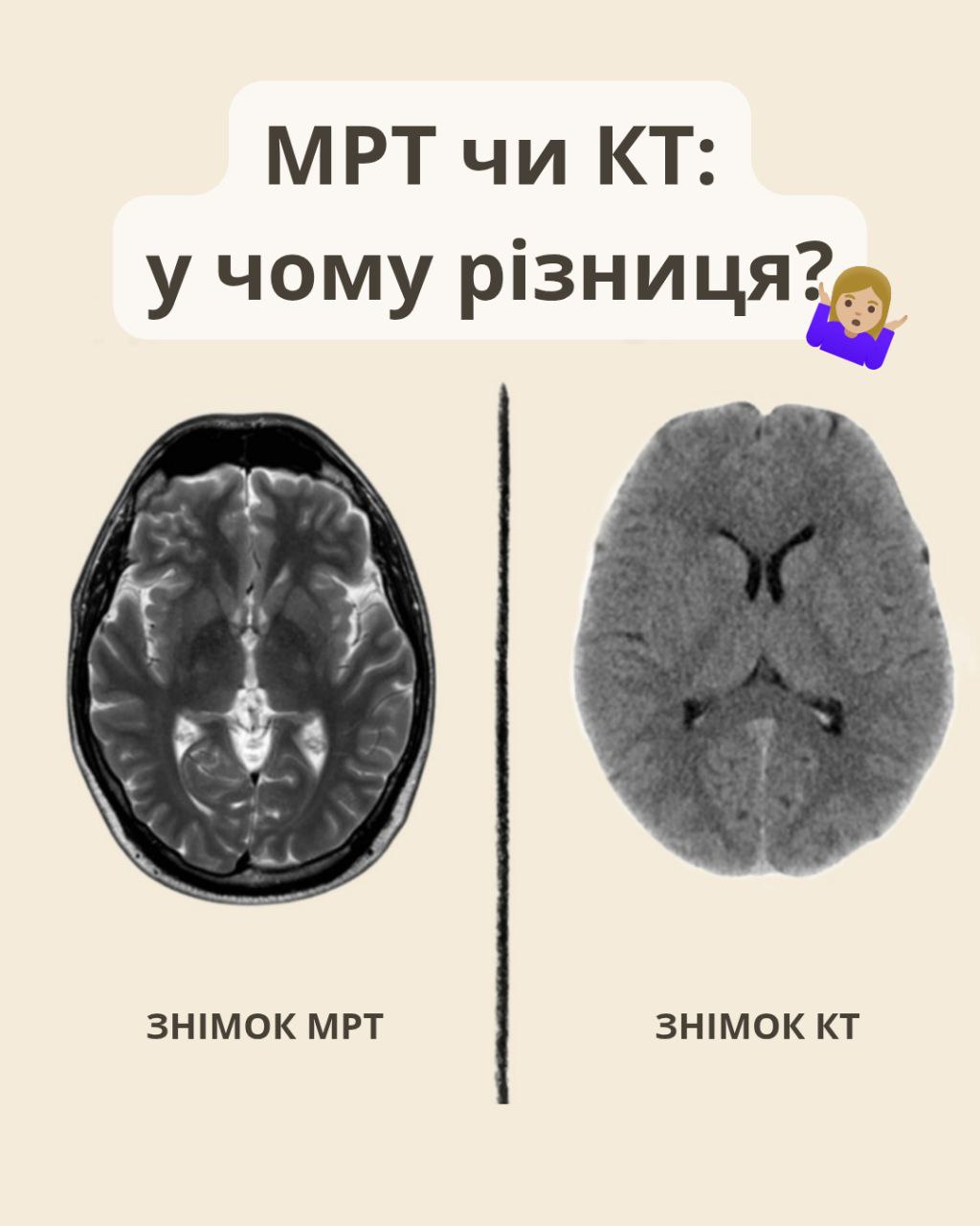 МРТ чи КТ: у чому різниця?